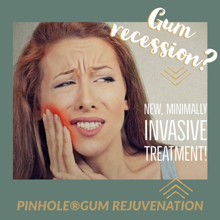 Pinhole Technique, a new minimally invasive treatment for gum recession